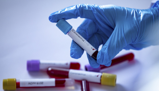 В Ужгороді за добу виявили 82 нові випадки коронавірусної інфекції